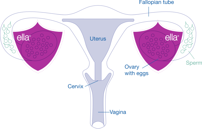 Diagram of a uterus